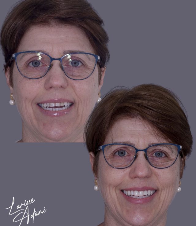 Resultado