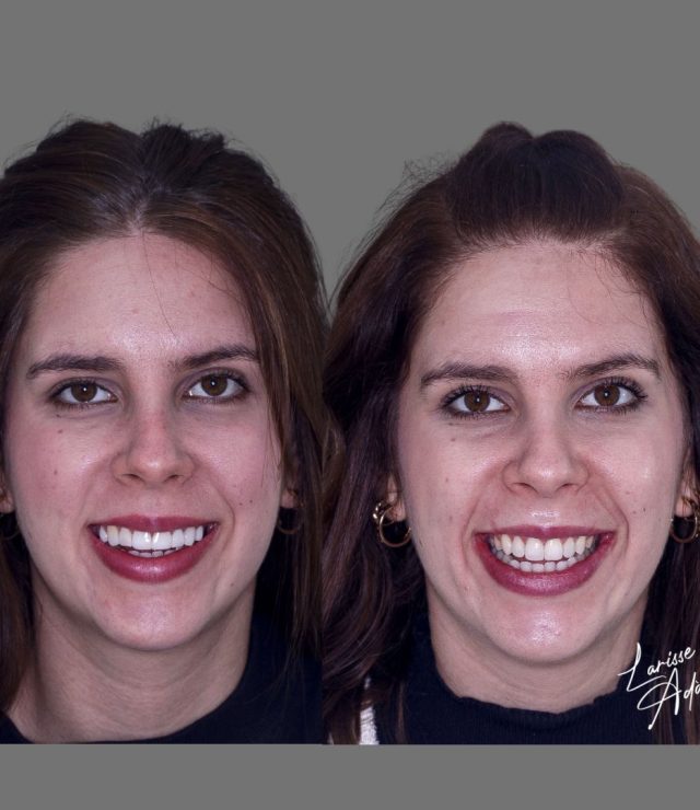 Resultado