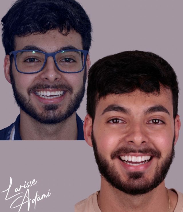 Resultado