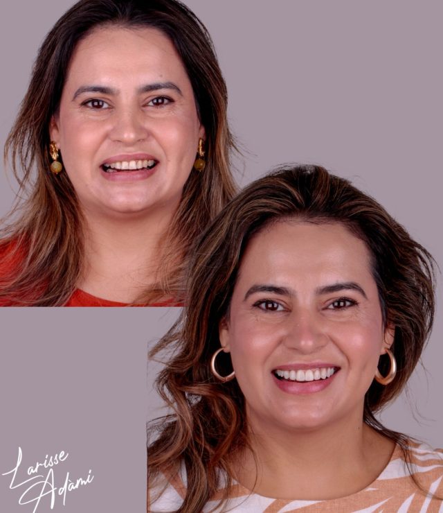 Resultado